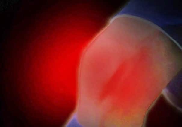 HALLOA-bild 1 HALLOA-bild 1